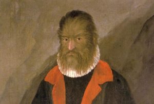 Lee más sobre el artículo HIPERTRICOSIS, QUÉ ES