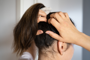 Lee más sobre el artículo PICOR EN EL CUERO CABELLUDO: ALERGIAS Y OTRAS CAUSAS