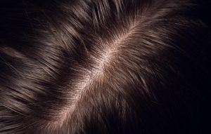 Lee más sobre el artículo CUIDAR EL CUERO CABELLUDO PARA TENER UN CABELLO SANO