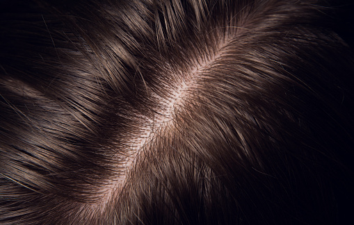 En este momento estás viendo CUIDAR EL CUERO CABELLUDO PARA TENER UN CABELLO SANO